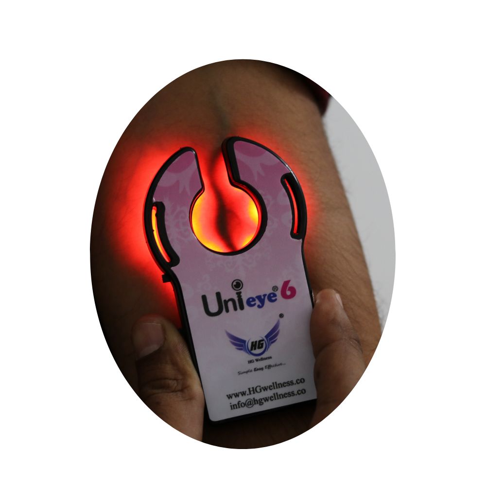 HGVF Unieye6